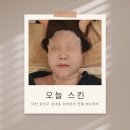 상대동6 | [대전 유성구 상대동 피부관리] 오늘 스킨 수분관리 후기