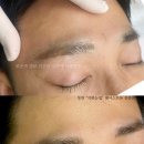 푸른자연 | 동탄 남자눈썹 50대 푸른 잔흔, 레이저 없이 자연스럽게 커버한 후기 (헤어스트록)