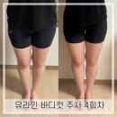 압구정로데오) 유라인 지방분해주사 ‘허벅지컷주사’로 허벅지 사이 멀어지기 기원 4회차 후기