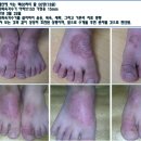 크린피부과 이미지