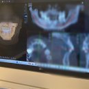 연신내역3번출구앞 김치과 | 치과 답십리 장안동 인비절라인교정치과 인비절라인 교정후기 발치교정 상담후기 치아교정 상담...