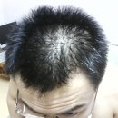 Dam 무료체험 이벤트에 선정된후 탈모가 많이 개선되었습니다. 이미지