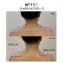 이진쵸이스