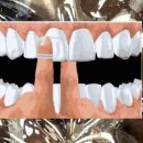 올바른 치실 사용법! 이미지