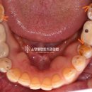 소망플란트치과의원 이미지