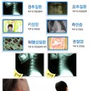 서울건강의료기 이미지