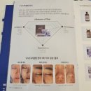 첨단에스테틱 더피움에스테틱, 피부 톤·결·광까지 잡아준 다이아몬드 무결점관리 후기