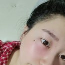 삼계약국 | 내서읍 안과 다래끼 나서 삼성안과 다녀왔어요ㅠㅠ