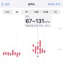 미뤘던 매복 사랑니 4개 발치 후기, 통증, 붓기 등