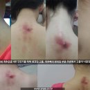 바른자세척추운동 이미지