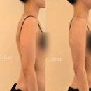 (주)한주에너지 | 신논현바디관리 에너지테라피 캐롤뷰티 재방문 후기