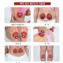 칠성메디칼 이미지