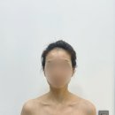 위드미 포항용흥점 | 포항피부관리 에르모듀 맞춤관리 뷰맞집 벨루위드미