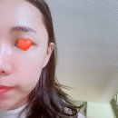 아송헤어 | 광주피부관리 잘하는 더미인나라 충장점 하이프리프팅+물방울리프팅 재방문후기