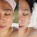 광진구피부관리[에스테틱]작은얼굴과리프팅고객님의후기자연미인에스테틱에서