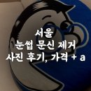 👀서울 눈썹문신 제거 후기(사진ㅇ,마취크림, 위치, 시간, 가격 비용) a.k.a 문신 지워주는 영수쌤