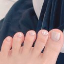 아우룸네일 | &lt;아우룸79뷰티네일 내성발톱 무좀 발각질 네일 문제성발&gt;