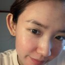 미가피부과의원 | 교대피부과 스킨부스터 쥬베룩스킨 1바이알 5cc 후기｜모공·피부결, 자가 콜라겐 부스터 효과간증후기