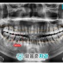 행운동-46 네이버블로그