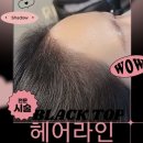 탑커버링 이미지