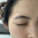 뷰티 썸 스킨 이미지