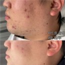 솜 에스테틱 네이버블로그