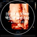 HOME PLUS 작전점 | [임신기록] 백일해주사_ 시기, 가격, 저렴한 곳 찾기(feat.심평원),백신품귀