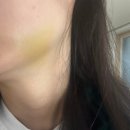 이튼치과의원 | 전주 소문난 사랑니 공장 <이튼튼치과> 사랑니 발치는 무조건 이 곳에서 하셔야 합니다 (궁서체)