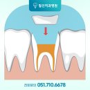 퍼즐치과기공소 이미지