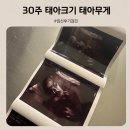 31 | 30주 태아 무게 31주 임신 후기 임산부 적정 체중