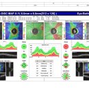 시야안경원 이미지