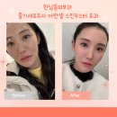 아란스킨베리디아 | 한남동피부과 줄기세포주사 아란셀 스킨부스터 효과