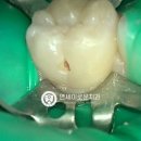 연세이로운치과의원 이미지