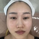 마곡피부관리 희아로움 마곡본점 미백관리 후기