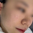 울산피부관리“올가드림뷰티” 삼산점 물광관리로 피부수분 채워요!