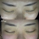 3745 | 분당 모공관리 인스타에서 핫한 포어핏 솔직후기