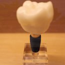 바른임플치과의원 이미지