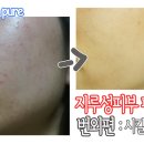 혜연스킨케어
