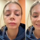 NO.1 자동차피부과 이미지