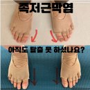 은아약국 | 대방동 필라테스 방치하면 안 좋은 족저근막염 언니네 상남점에서 개선해요