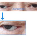 좋은의안 이미지