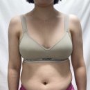 신촌 복부 무한람스 당일부터 2개월차까지 솔직 후기 + 총평