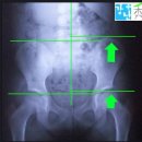 발안제일의원 | [자전거피팅] GYCC방문 - 무릎통증을 잡아보자! (부제: 넥슨이 길들이기)