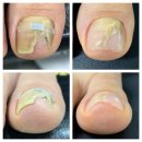 마스터케어 이미지