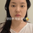 분도메디컬 | 강남역 피부과 비올메디컬 셀리뉴 고주파 리프팅 모공축소 중안부 팔자 피부관리 후기