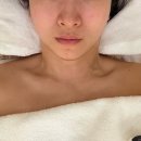 대연동 피부관리 라인켈리 에스테틱 아쿠아필 물방울 리프팅 받은 후기
