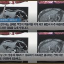 경화식품 이미지