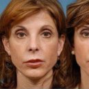 예사랑병원 이미지