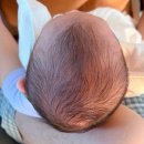 행복한소아청소년과의원 | 4개월 아기 사두 확인을 위한 하늘빛어린이병원 방문 후기