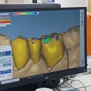 원치과기공소 이미지